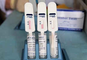 Экспресс-тестирование на ВИЧ в Шарыпове